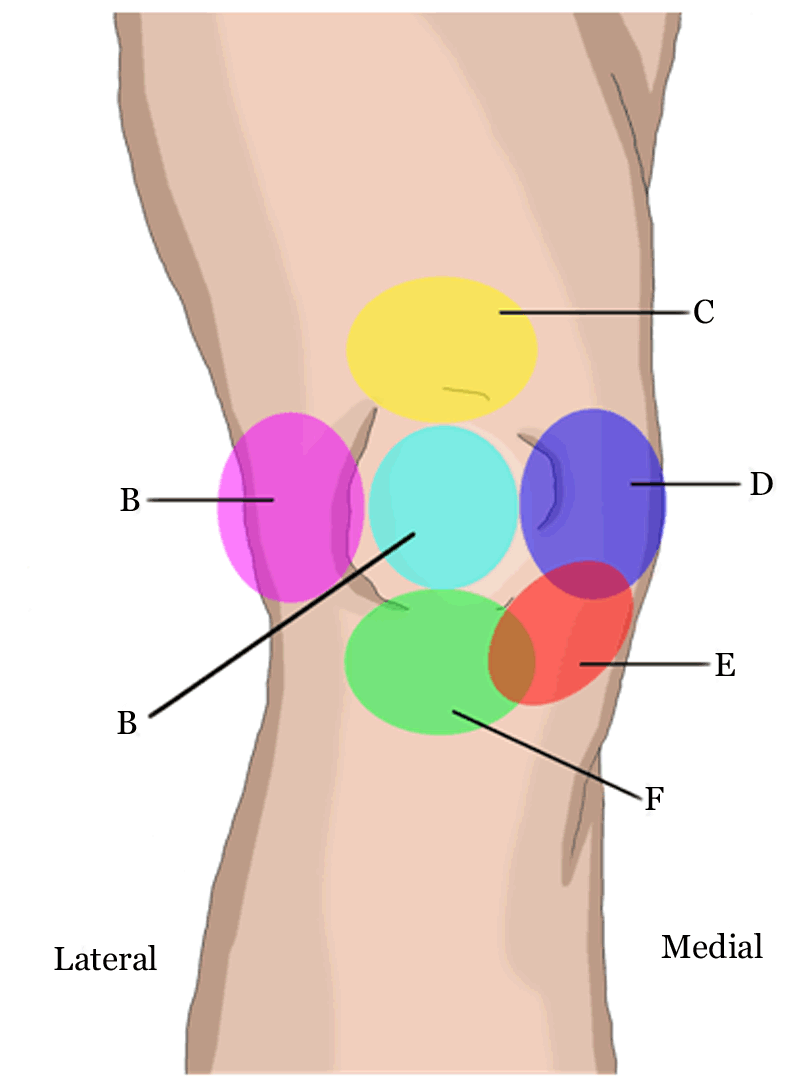 medial pica syndrome medial pica syndrome
